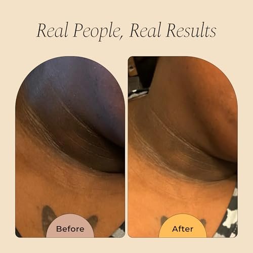Glo Melanin Magic Eraser Dark Spot Cream for Face, Body & Sensitive Areas – Inner Thighs Remover, Faded Cream for Black Spots, Made in USA, 1.7 Oz Avelisse