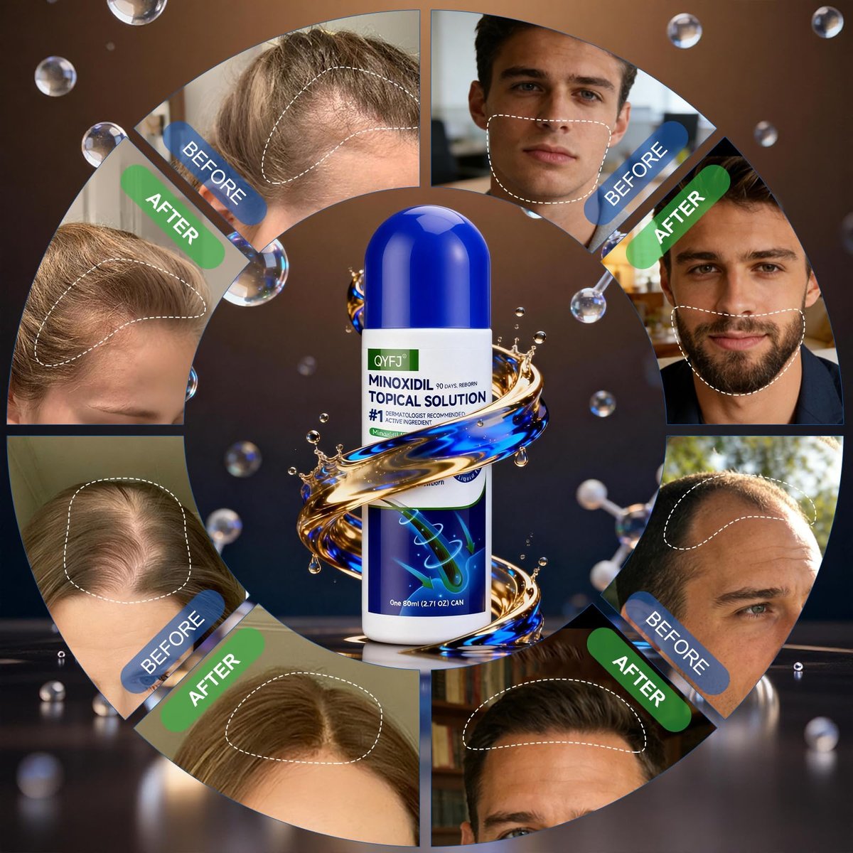 6 Pack 5% Minoxidil for Men and Women – Biotin-Infused Hair & Beard Growth Serum with Sponge Applicator, 8-Month Supply (6 x 2.7 FL OZ) Avelisse