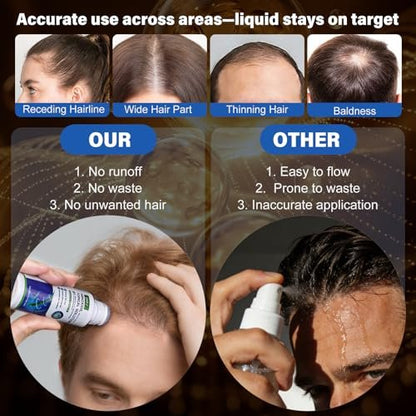 6 Pack 5% Minoxidil for Men and Women – Biotin-Infused Hair & Beard Growth Serum with Sponge Applicator, 8-Month Supply (6 x 2.7 FL OZ) Avelisse