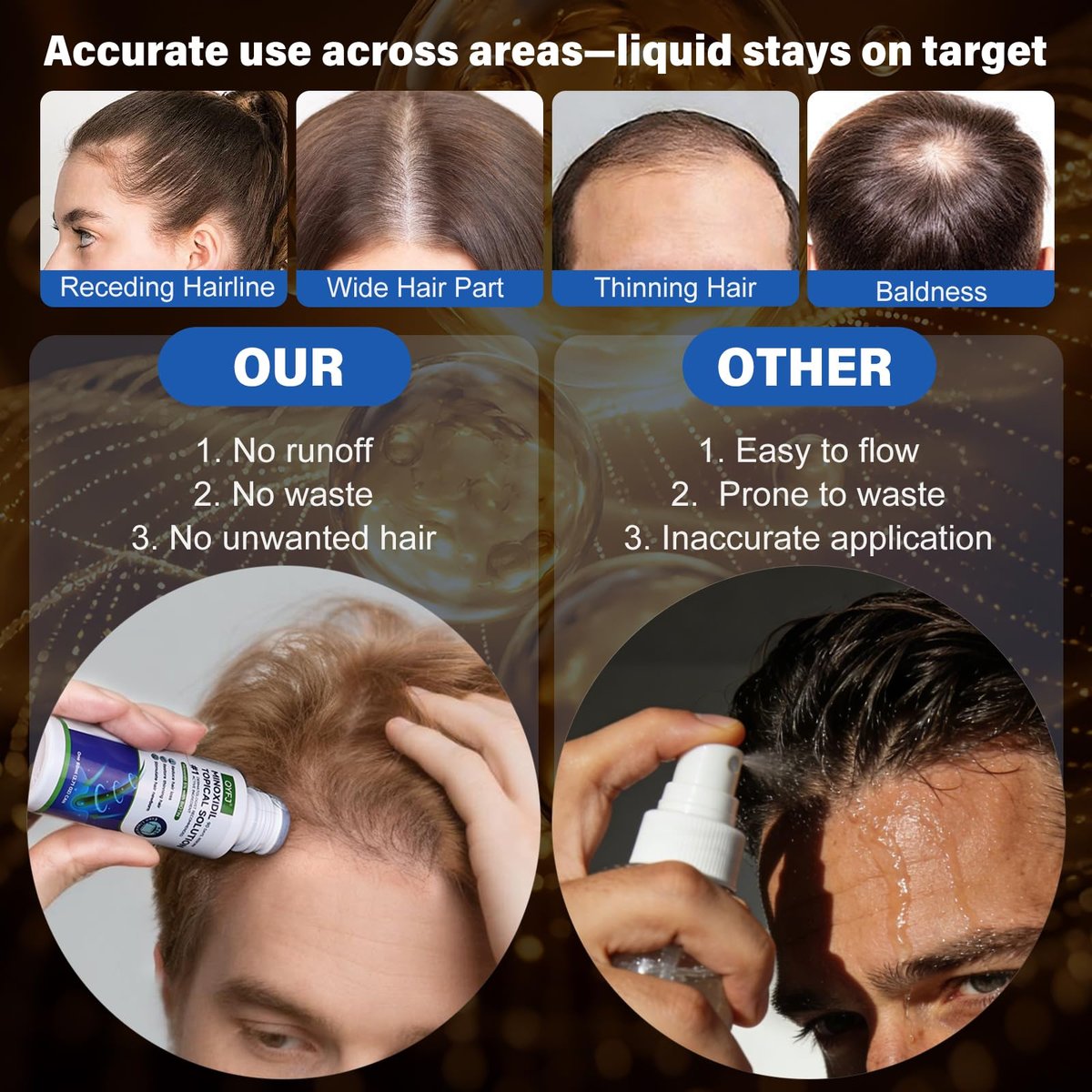6 Pack 5% Minoxidil for Men and Women – Biotin-Infused Hair & Beard Growth Serum with Sponge Applicator, 8-Month Supply (6 x 2.7 FL OZ) Avelisse