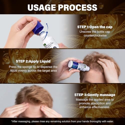 6 Pack 5% Minoxidil for Men and Women – Biotin-Infused Hair & Beard Growth Serum with Sponge Applicator, 8-Month Supply (6 x 2.7 FL OZ) Avelisse
