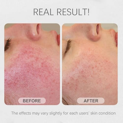 Bmrewax Rice Face Mask - Gentle Exfoliating Wash Off Facial Mask for Dull, Rough Skin, Pore Clearing, Remove Dead Skin Cells for All Skin Types (3.53 Fl Oz)