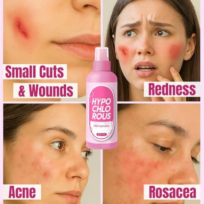 HOCl Hypochlorous Acid Spray Pure 250 ml / 8.4 oz – Natural Skin & Face Mist – Gentle Refreshing Formula for Cleansing, Soothing & Deodorizing – Alcohol-Free & pH Balanced