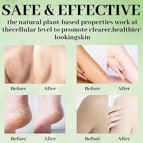 Tea Tree Soap Bar - Natural Relief for Foot Discomfort & Skin Irritations, Gentle Exfoliating Body Soap for Men & Women - görsel 6