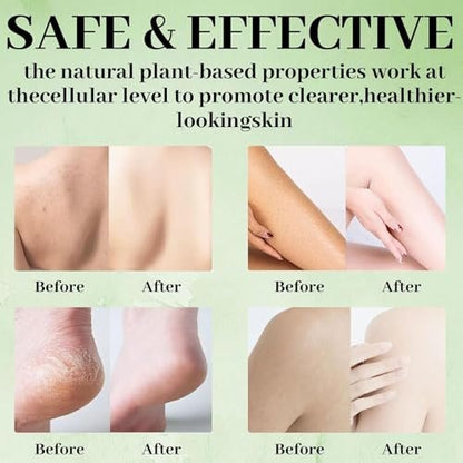 Tea Tree Soap Bar - Natural Relief for Foot Discomfort & Skin Irritations, Gentle Exfoliating Body Soap for Men & Women