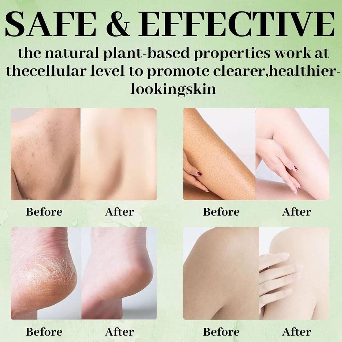 Tea Tree Soap Bar - Natural Relief for Foot Discomfort & Skin Irritations, Gentle Exfoliating Body Soap for Men & Women - görsel 5