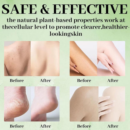 Tea Tree Soap Bar - Natural Relief for Foot Discomfort & Skin Irritations, Gentle Exfoliating Body Soap for Men & Women