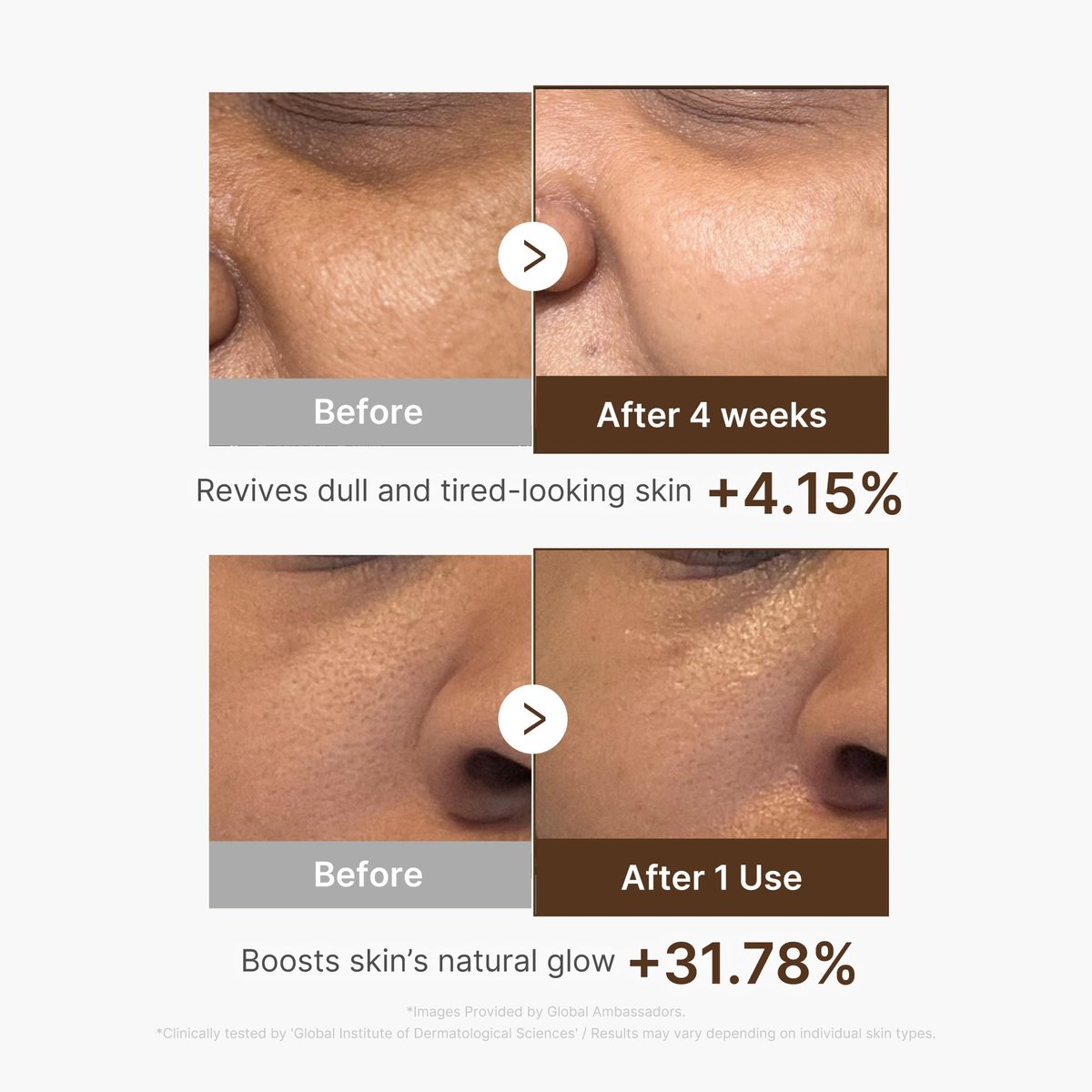 Medicube Deep Vitamin C Capsule Serum | Hydrating Vitamin C Serum for Dull & Uneven-Looking Skin | Liposome Capsules for Smooth, Radiant Texture | Korean Skincare 1.01 fl.oz Avelisse