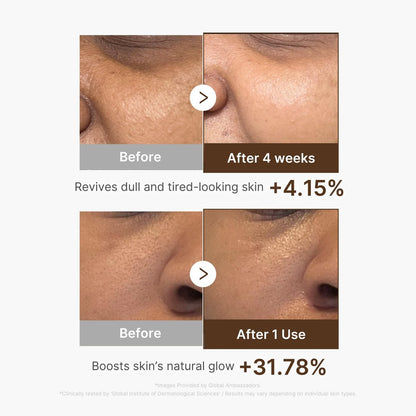 Medicube Deep Vitamin C Capsule Serum | Hydrating Vitamin C Serum for Dull & Uneven-Looking Skin | Liposome Capsules for Smooth, Radiant Texture | Korean Skincare 1.01 fl.oz Avelisse