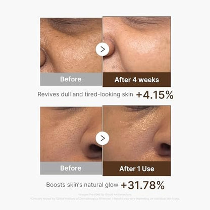 Medicube Deep Vitamin C Capsule Serum | Hydrating Vitamin C Serum for Dull & Uneven-Looking Skin | Liposome Capsules for Smooth, Radiant Texture | Korean Skincare 1.01 fl.oz Avelisse