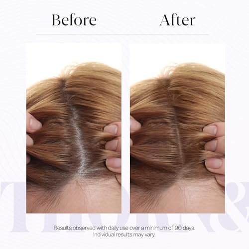 THORN & BERRY Hair Growth Serum for Thinning Hair | Thicker Fuller Hair Thickening Serum with Rosemary Oil, Saw Palmetto, Biotin, Multi Peptides, Redensyl & Caffeine | Density DHT Blocker for Women Avelisse