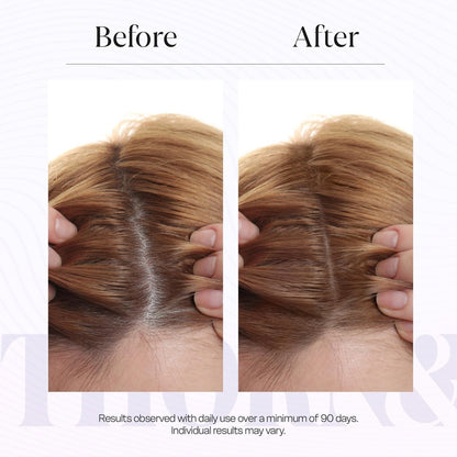 THORN & BERRY Hair Growth Serum for Thinning Hair | Thicker Fuller Hair Thickening Serum with Rosemary Oil, Saw Palmetto, Biotin, Multi Peptides, Redensyl & Caffeine | Density DHT Blocker for Women Avelisse