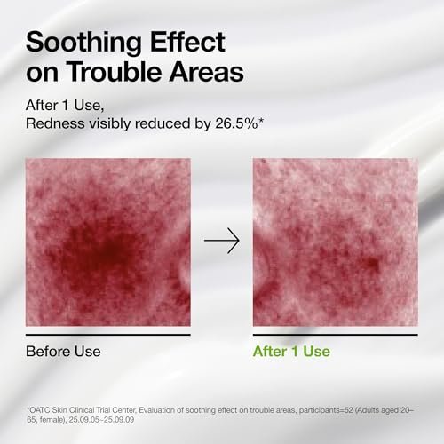 ANUA Azelaic Acid CICA Skin Soothing Moisturizer - Lightweight Redness Relief for Acne Prone Skin, Fragrance Free, Korean Skincare, 3.38 fl oz - görsel 16