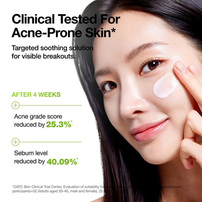 ANUA Azelaic Acid CICA Skin Soothing Moisturizer - Lightweight Redness Relief for Acne Prone Skin, Fragrance Free, Korean Skincare, 3.38 fl oz