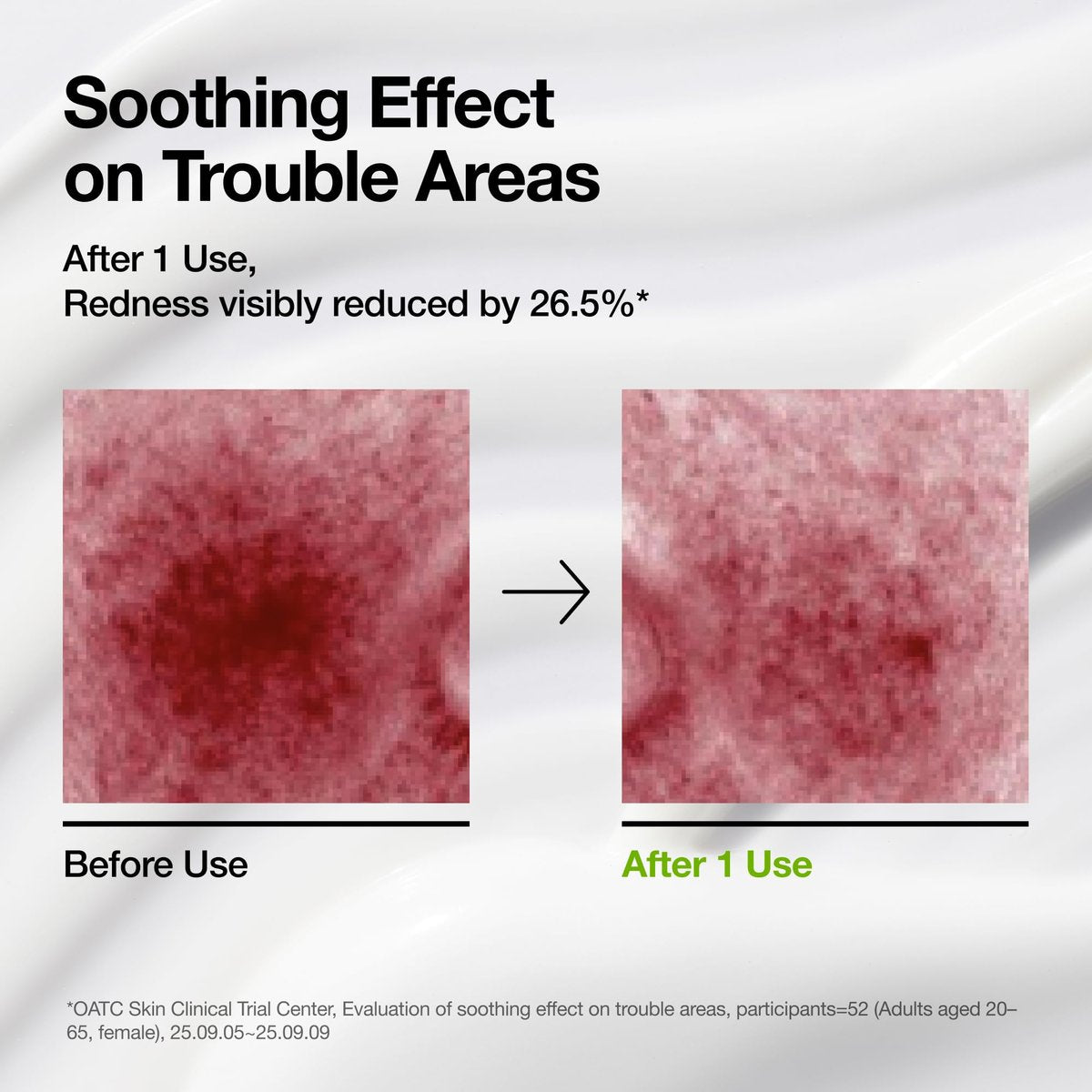 ANUA Azelaic Acid CICA Skin Soothing Moisturizer - Lightweight Redness Relief for Acne Prone Skin, Fragrance Free, Korean Skincare, 3.38 fl oz - görsel 15
