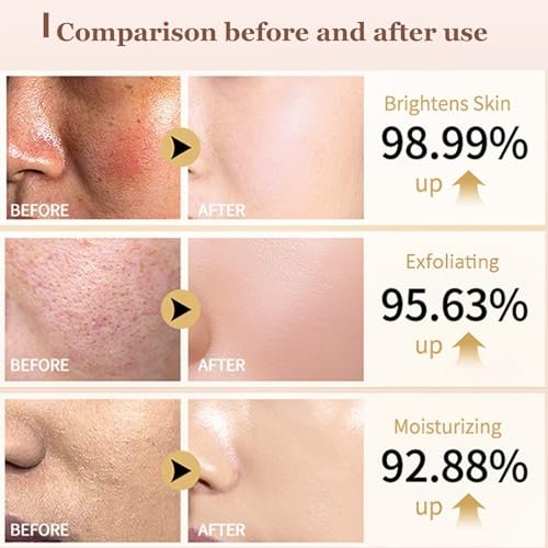 Rice Peel Shot Glow Rice Ampoule Duo – Pore Minimizing Gentle Peel & Deep Hydration with Black Rice Exfoliant for All Skin Types (6.76 Fl Oz, 2-Pack) Avelisse