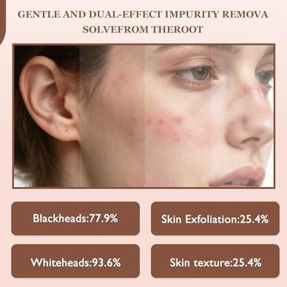 Rice Peel Shot Glow Rice Ampoule Duo – Pore Minimizing Gentle Peel & Deep Hydration with Black Rice Exfoliant for All Skin Types (6.76 Fl Oz, 2-Pack) Avelisse