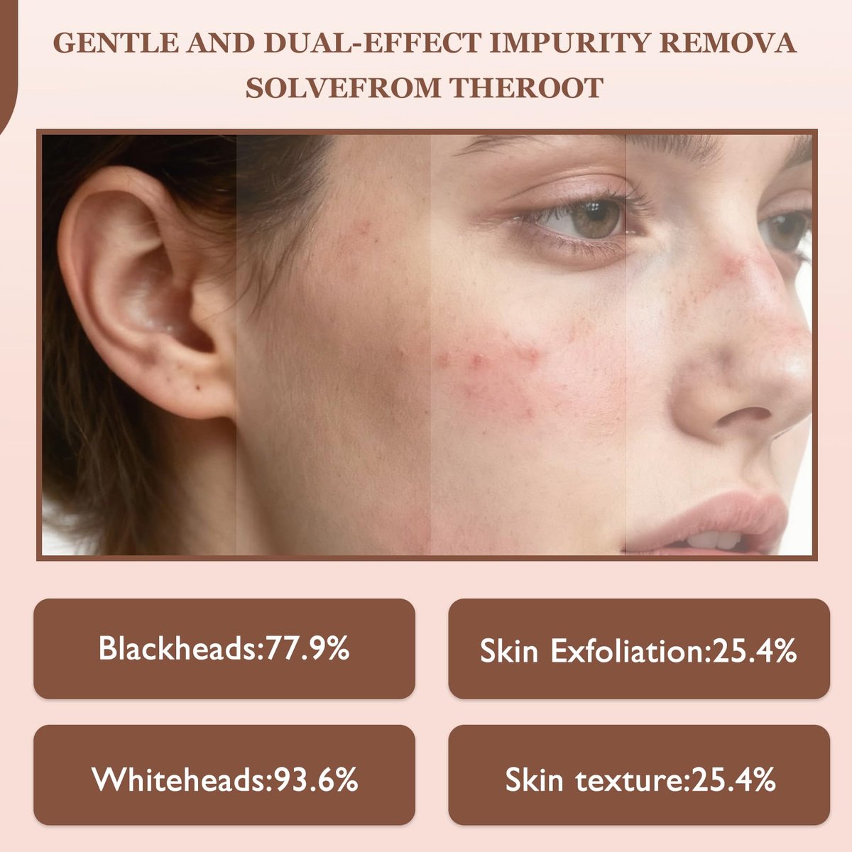 Rice Peel Shot Glow Rice Ampoule Duo – Pore Minimizing Gentle Peel & Deep Hydration with Black Rice Exfoliant for All Skin Types (6.76 Fl Oz, 2-Pack) Avelisse