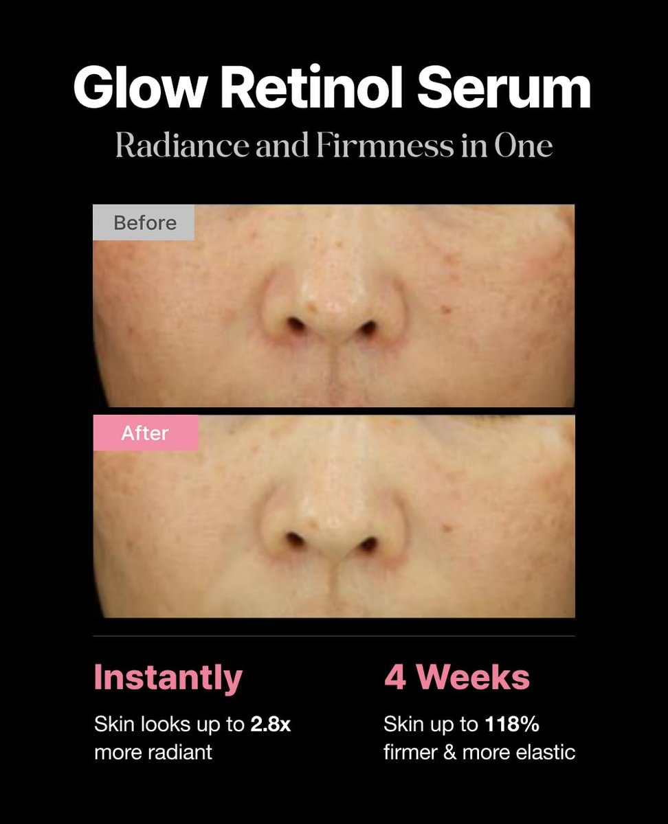 Delere Caviar Glow Smoothing Serum with Caviar Collagen, Niacinamide & Retinol – Korean Glass Skin Serum, 1.7 oz Avelisse