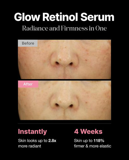 Delere Caviar Glow Smoothing Serum with Caviar Collagen, Niacinamide & Retinol – Korean Glass Skin Serum, 1.7 oz Avelisse