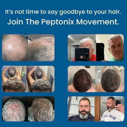 Peptonix Copper Peptide Hair Growth Serum – Copper Peptides, Ginseng, Licorice & Biotin – for Hair Loss & Thinning Hair Avelisse