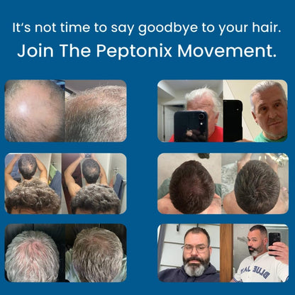 Peptonix Copper Peptide Hair Growth Serum – Copper Peptides, Ginseng, Licorice & Biotin – for Hair Loss & Thinning Hair Avelisse