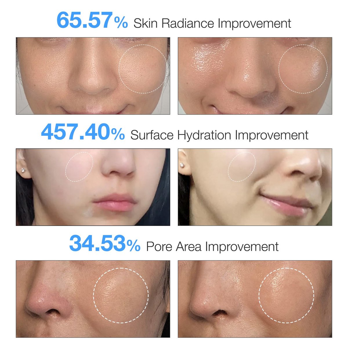 glow.m Cryo Sonic with Moisture Booster Gel (100g) | Next Level Glow Set for Glass Skin - görsel 9