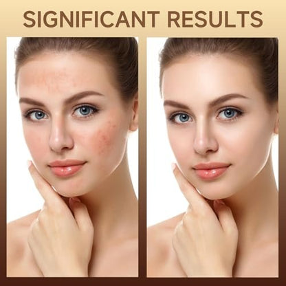 HZENPPOR PDRN Serum Cream – 99% Pure Salmon DNA Advanced Face Moisturizer with Collagen, Hyaluronic Acid & Niacinamide for Glass Glow Skin Hydration, Uneven Skin Tone (20g, Unscented)