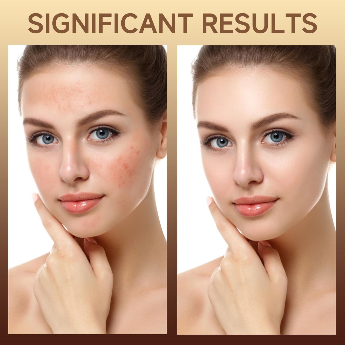 HZENPPOR PDRN Serum Cream – 99% Pure Salmon DNA Advanced Face Moisturizer with Collagen, Hyaluronic Acid & Niacinamide for Glass Glow Skin Hydration, Uneven Skin Tone (20g, Unscented) - görsel 11