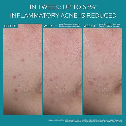 La Roche-Posay Effaclar BPO Multi-Target Acne Treatment with 5.5% Micronized Benzoyl Peroxide - Acne Cream for Face, Targets Oily Skin, Blackheads & Prevents Pimples, 20ml Avelisse