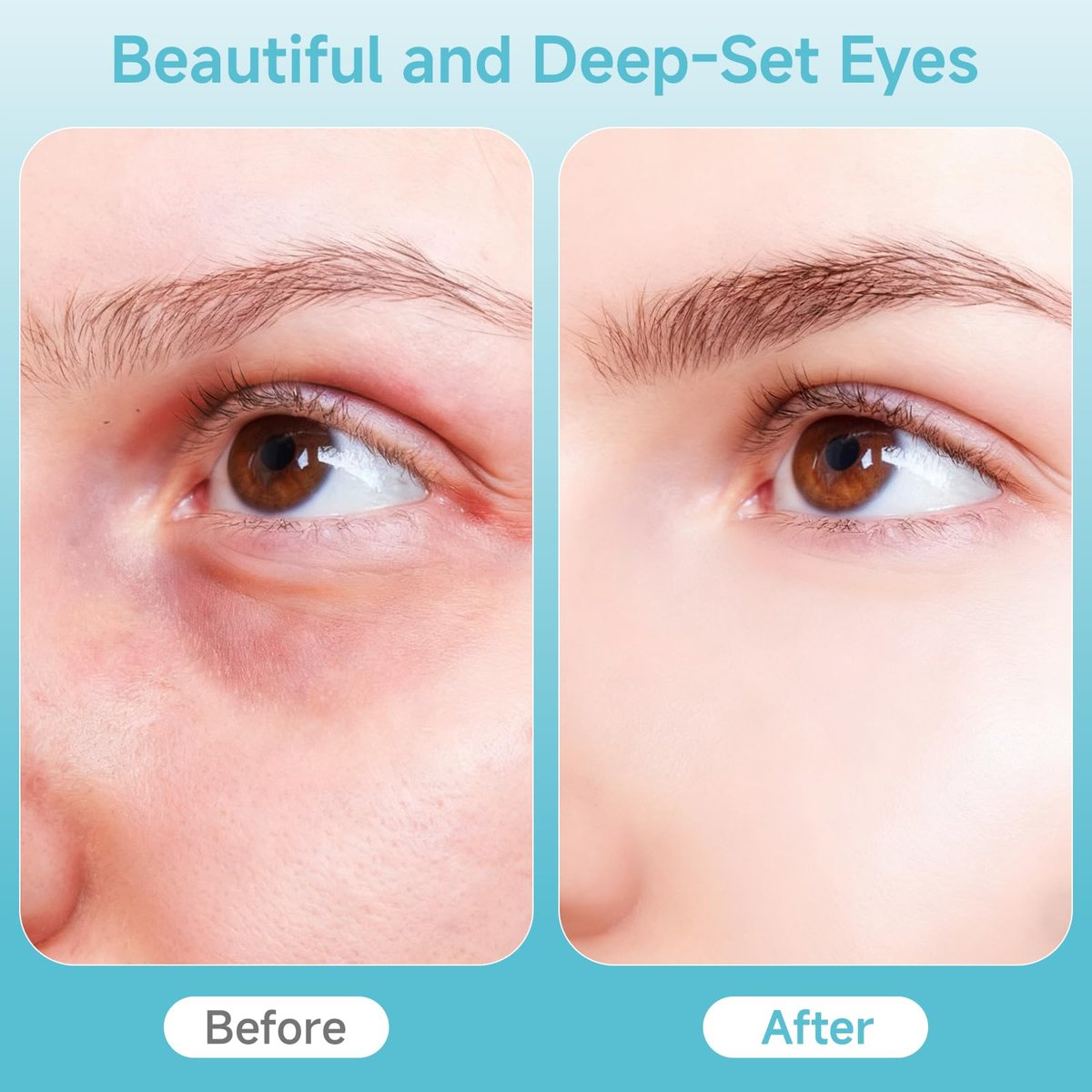 Depuffing Wand for Face & Eyes – 2-in-1 Cold and Heat Facial Therapy with Adjustable Temp; Beauty Wand, Face Roller and Eye Massage Tool to Reduce Puffiness, Dark Circles & Revive Skin Radiance Avelisse