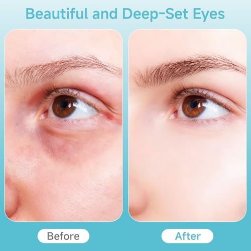 Depuffing Wand for Face & Eyes – 2-in-1 Cold and Heat Facial Therapy with Adjustable Temp; Beauty Wand, Face Roller and Eye Massage Tool to Reduce Puffiness, Dark Circles & Revive Skin Radiance Avelisse