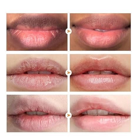 Lip Lightening Lip Balm for Dark Lips – Moisturizing & Hydrating, Helps Fade Discoloration & Fine Lines, for Men and Women (2 Count) - görsel 7
