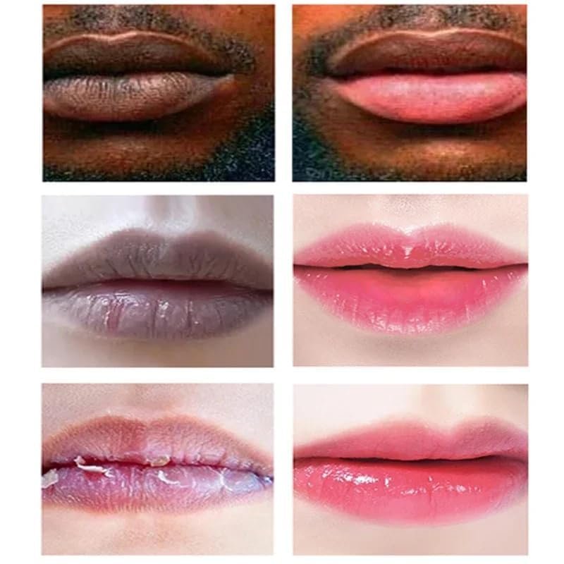 Lip Lightening Lip Balm for Dark Lips – Moisturizing & Hydrating, Helps Fade Discoloration & Fine Lines, for Men and Women (2 Count) - görsel 6