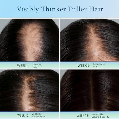 Rosemary Hair Growth Serum Roll On - 3% Rosemary, 3% Batana Oil, 2% Ginger Oil, 3% Aloe Vera Extract for Stronger Roots, Thicker Hair, Hair Loss Treatment, 0.85 Fl Oz - görsel 12