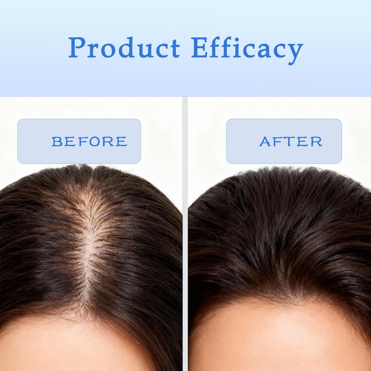 Rosemary Hair Growth Serum Roll On - 3% Rosemary, 3% Batana Oil, 2% Ginger Oil, 3% Aloe Vera Extract for Stronger Roots, Thicker Hair, Hair Loss Treatment, 0.85 Fl Oz - görsel 13