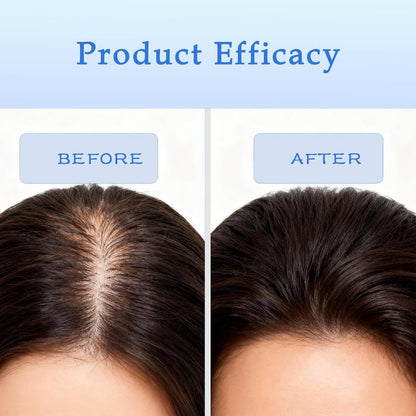 Rosemary Hair Growth Serum Roll On - 3% Rosemary, 3% Batana Oil, 2% Ginger Oil, 3% Aloe Vera Extract for Stronger Roots, Thicker Hair, Hair Loss Treatment, 0.85 Fl Oz