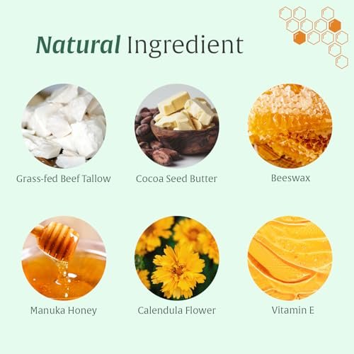 Whipped Honey Tallow Balm for Skin – 100% Grass-Fed Beef Tallow, Manuka Honey, Body Butter, Dry Skin Cream, Natural Moisturizing Cream for Dry, Sensitive Skin, Eczema & Body Care, 4 oz Avelisse