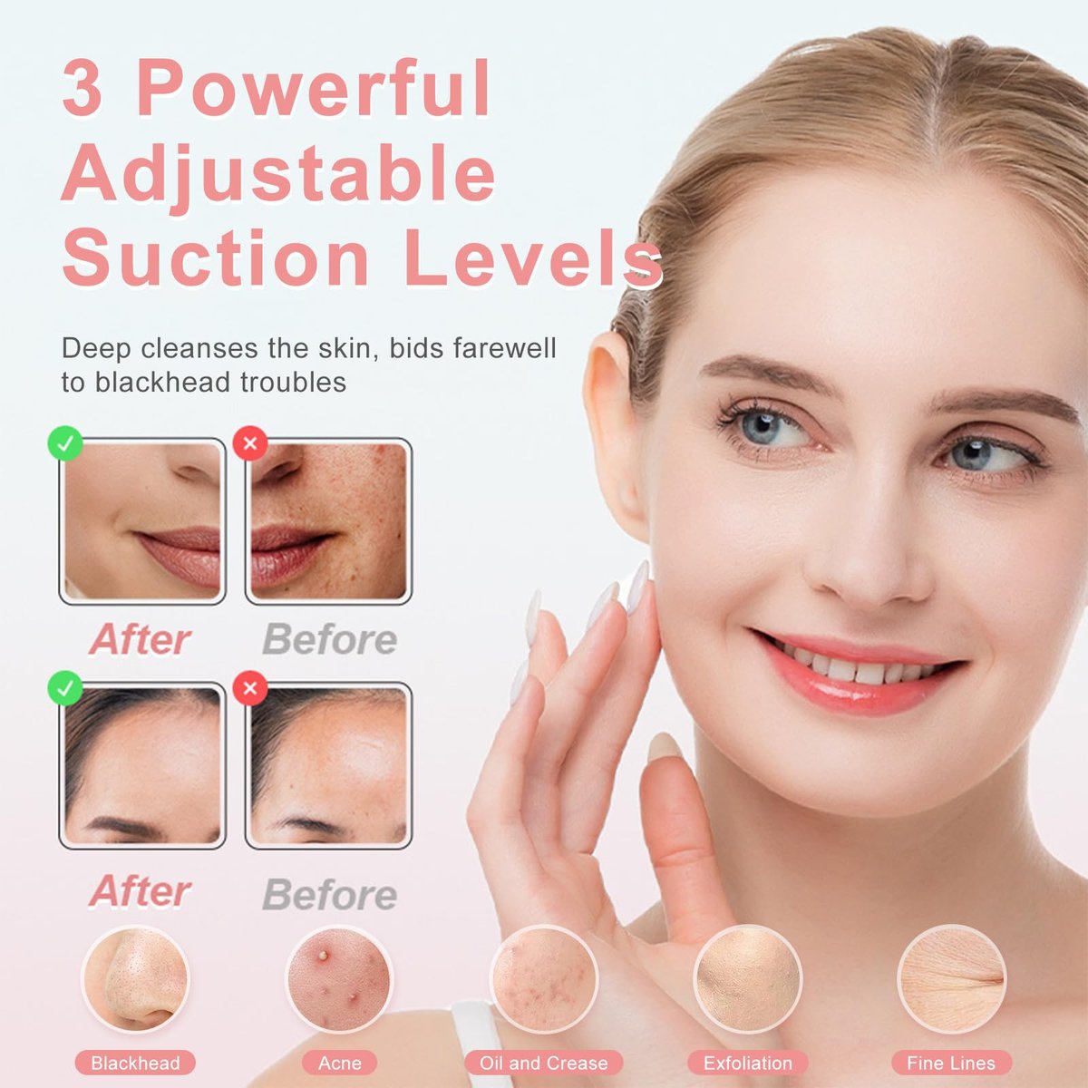 2026 Pore Vacuum Blackhead Remover - USB Rechargeable with 5 Heads & Spatula for Face Deep Cleansing Avelisse