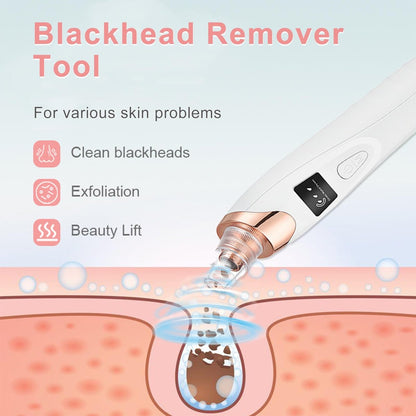 2026 Pore Vacuum Blackhead Remover - USB Rechargeable with 5 Heads & Spatula for Face Deep Cleansing Avelisse
