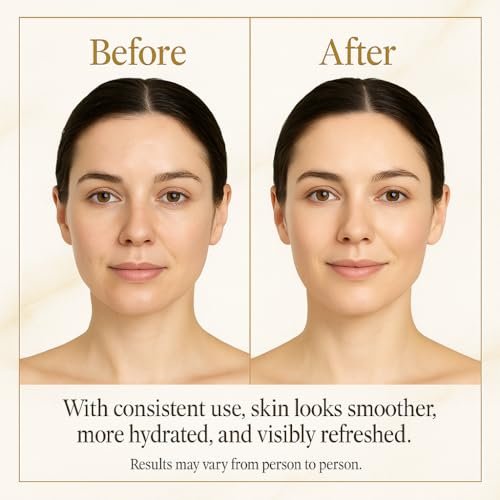 Neatique SE96 Advanced Snail 96% Mucin Power Essence 120ml - Hydrating & Repairing Snail Mucin Serum for Face with Snail Secretion Filtrate, 4 fl.oz Avelisse