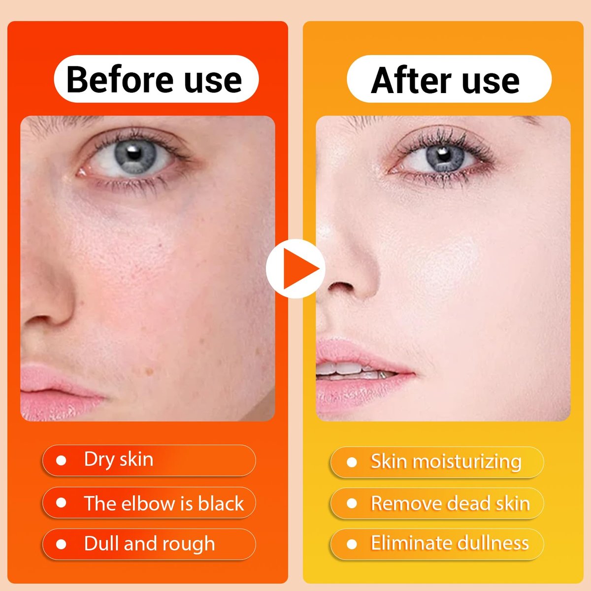 Peel Shot Keratin Care Kojic Acid Turmeric Spray – Exfoliating Body Spray with Retinol & Niacinamide for Face & Body, All Skin Types (100ml) Avelisse