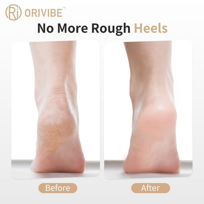 Orivibe Electric Callus Remover for Feet – 2 Speeds, Fine & Coarse Rollers, USB-C Rechargeable, 60-Min Runtime, Smooth Heels at Home