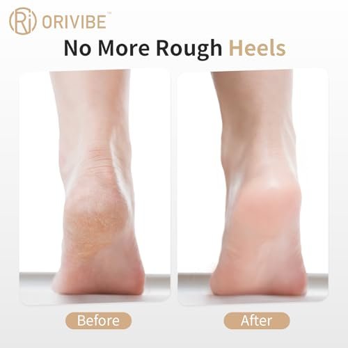 Orivibe Electric Callus Remover for Feet – 2 Speeds, Fine & Coarse Rollers, USB-C Rechargeable, 60-Min Runtime, Smooth Heels at Home - görsel 4