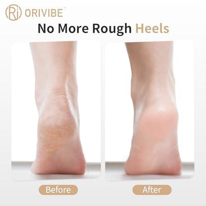 Orivibe Electric Callus Remover for Feet – 2 Speeds, Fine & Coarse Rollers, USB-C Rechargeable, 60-Min Runtime, Smooth Heels at Home