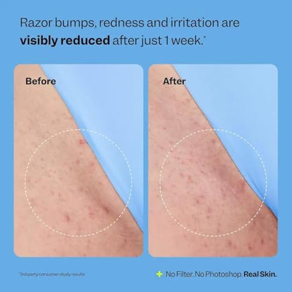 BETTENKO Smoothing Solution Ingrown Hair Treatment Serum – Soothe Razor Bumps, Bikini Line & More | 1.69 Fl Oz Avelisse