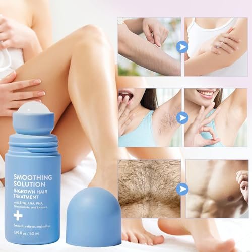 BETTENKO Smoothing Solution Ingrown Hair Treatment Serum – Soothe Razor Bumps, Bikini Line & More | 1.69 Fl Oz Avelisse