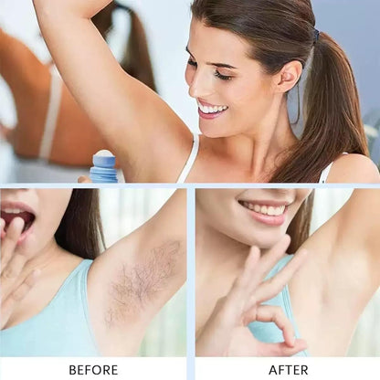 BETTENKO Smoothing Solution Ingrown Hair Treatment Serum – Soothe Razor Bumps, Bikini Line & More | 1.69 Fl Oz Avelisse