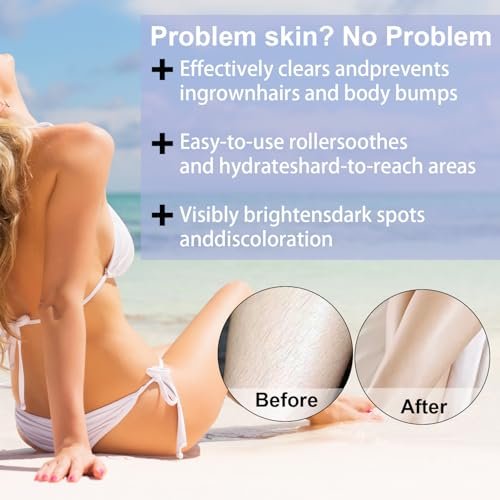 BETTENKO Smoothing Solution Ingrown Hair Treatment Serum – Soothe Razor Bumps, Bikini Line & More | 1.69 Fl Oz Avelisse