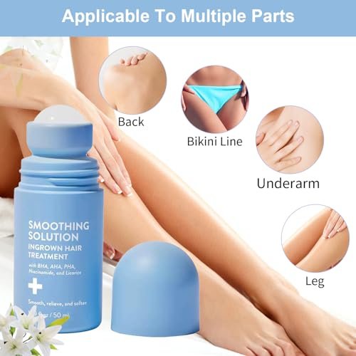 BETTENKO Smoothing Solution Ingrown Hair Treatment Serum – Soothe Razor Bumps, Bikini Line & More | 1.69 Fl Oz Avelisse